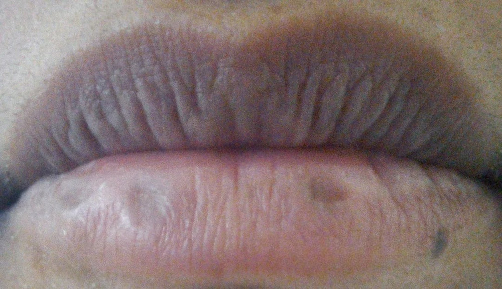 Before