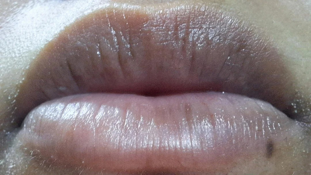 After